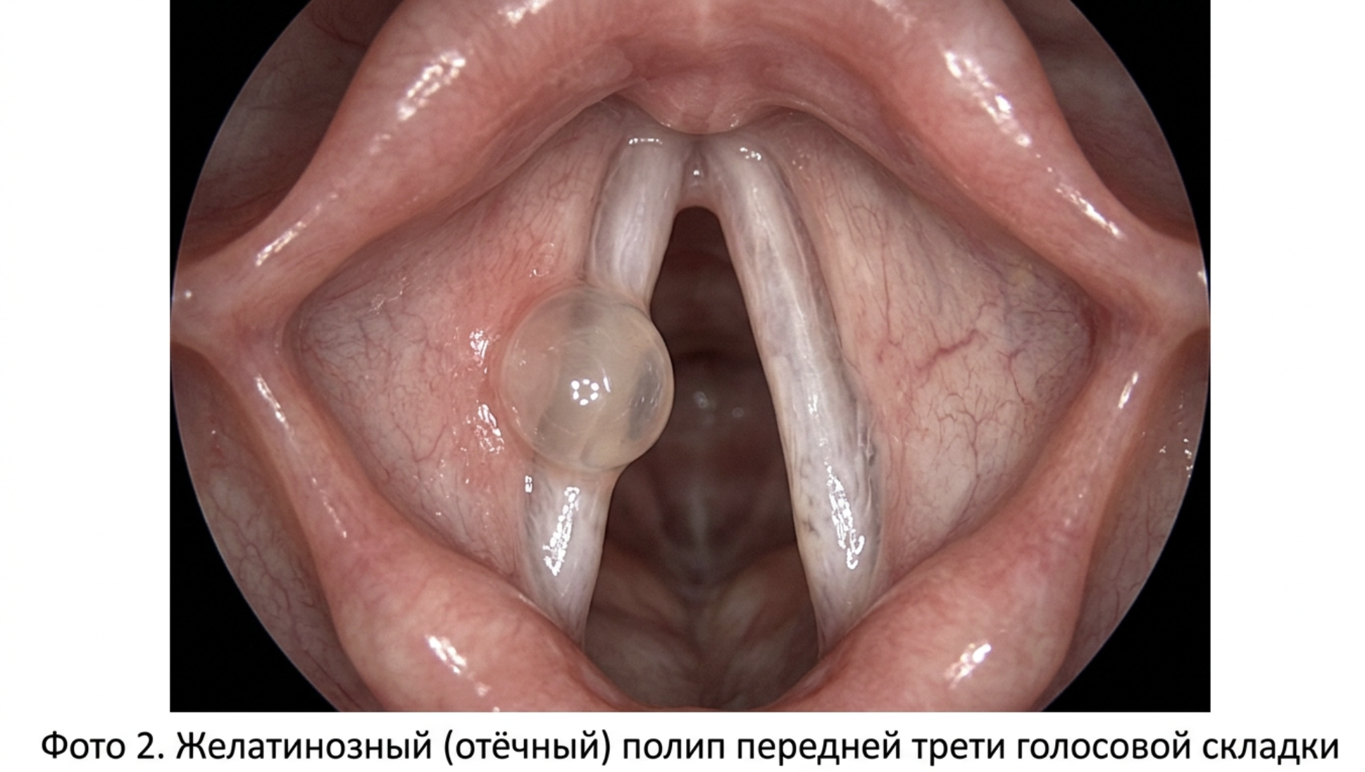 Физиология смены зубов