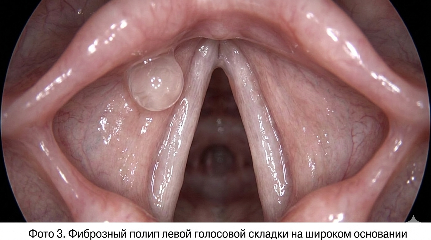 Физиология смены зубов